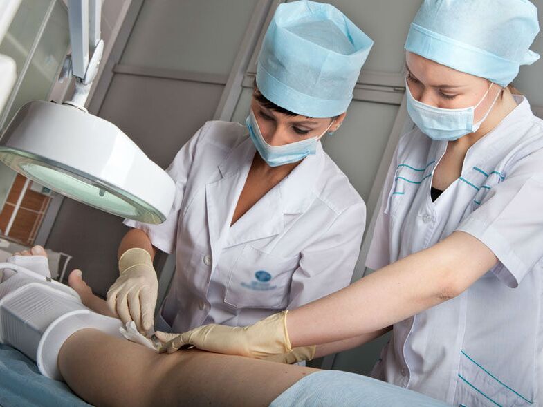 Laser ablation of varicose veins
